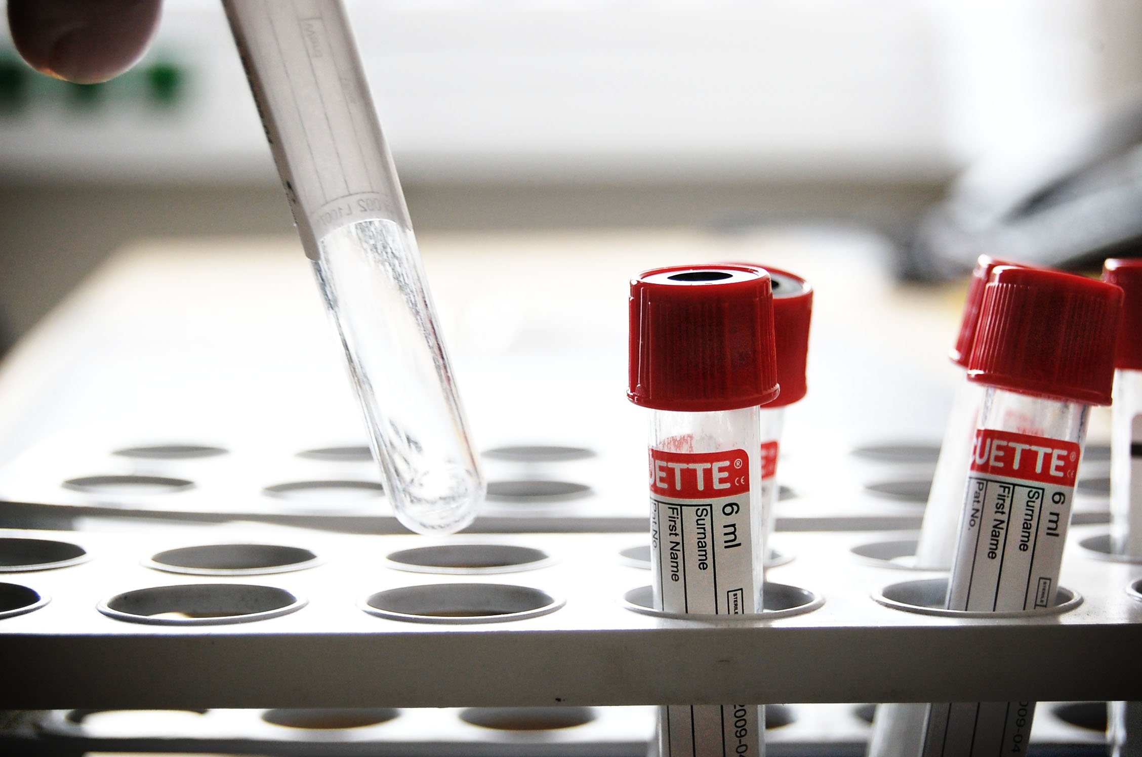 AKTION HIV/Syphilis Kombi-Schnelltest für € 15
